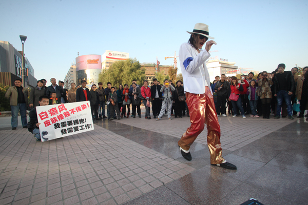 Chinese man shares Michael Jackson's skin issues