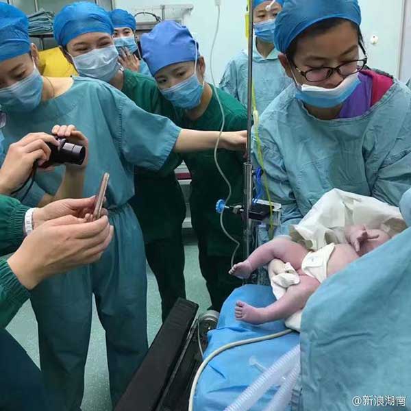 16 medical staff members help 140kg woman deliver baby