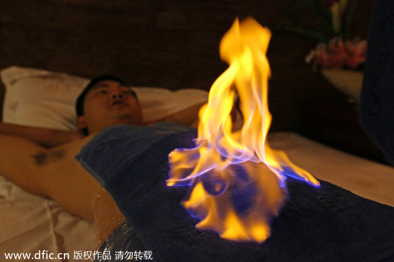 Fire therapy still warms hearts in China