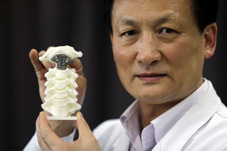 First 3D-printed artificial axis in China