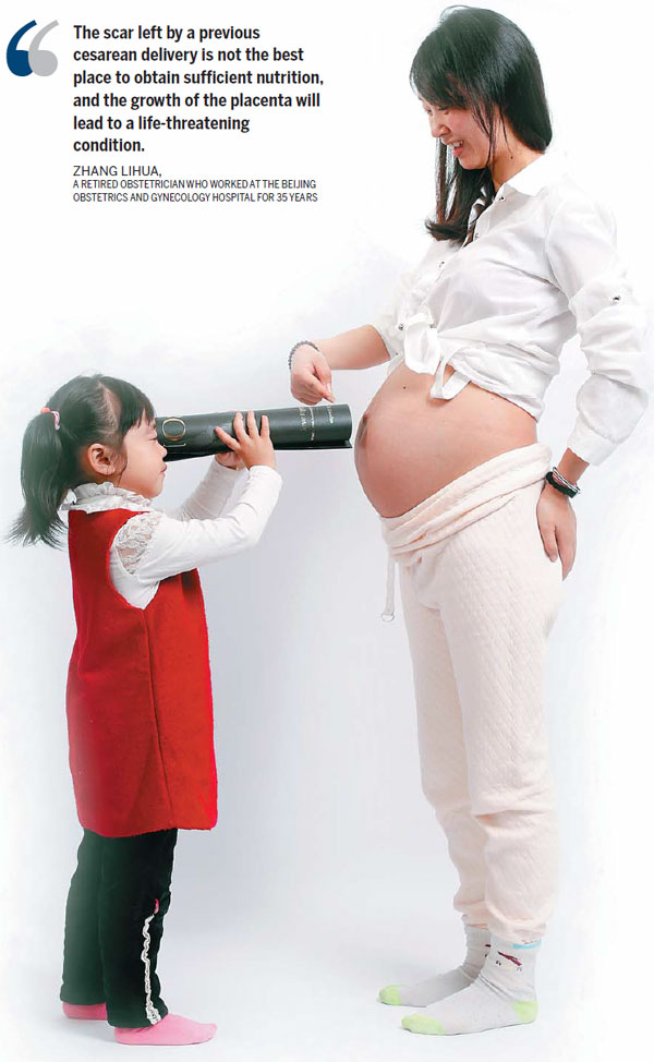 C-section is no longer cutting edge