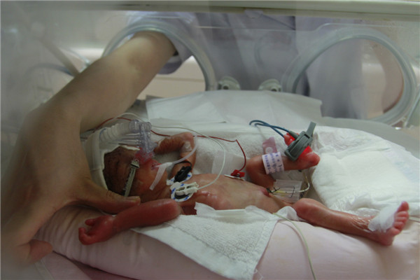 Palm-size baby born in C China