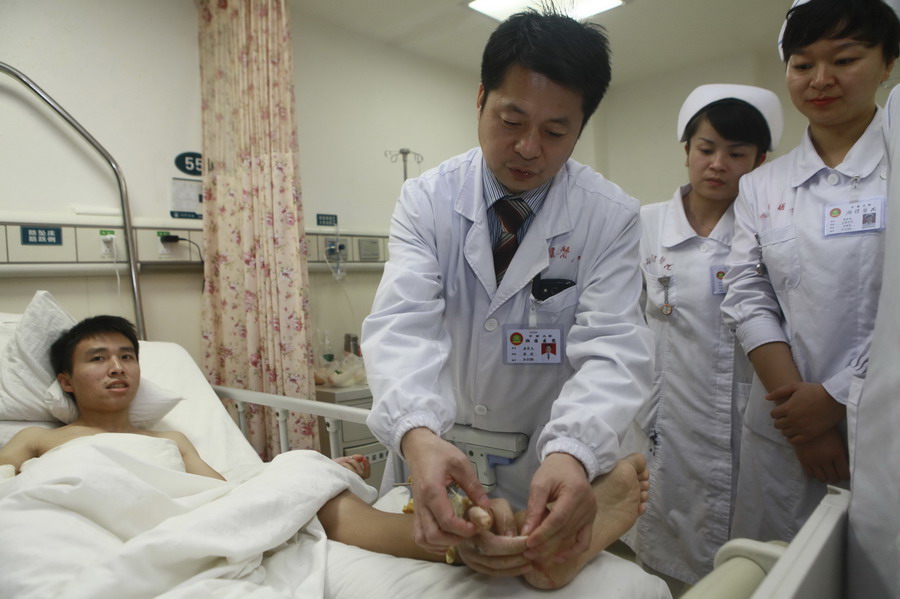 Chinese man has his right hand grafted to leg