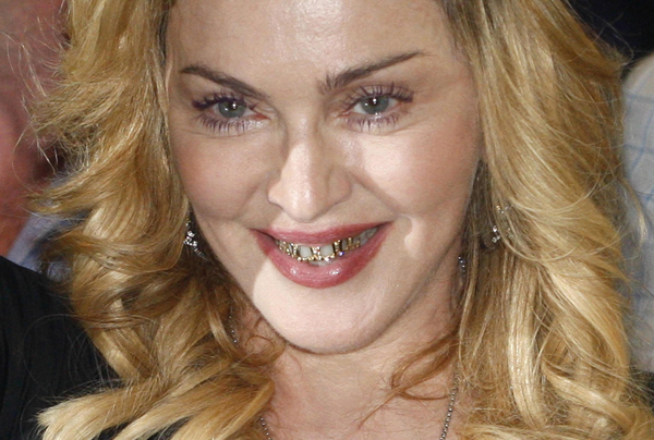 Madonna flaunts her new golden teeth