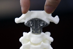 Man accepts a 3D-printed titanium half-skull