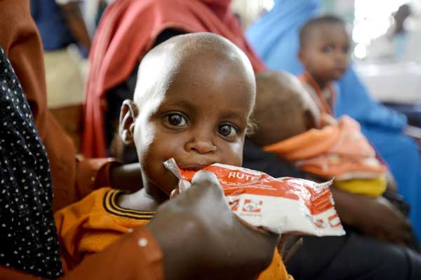 Five years since the famine, Somali children still stalked by menace of hunger